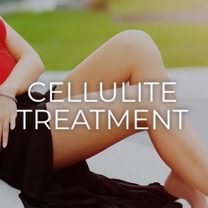 Cellulite Treatment in Albuquerque, NM