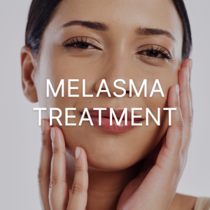 Melasma Treatment