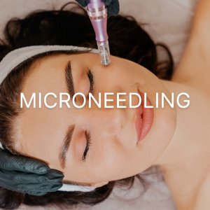 Microneedling