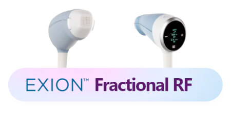 Skin rejuvenation using Exion Fractional RF